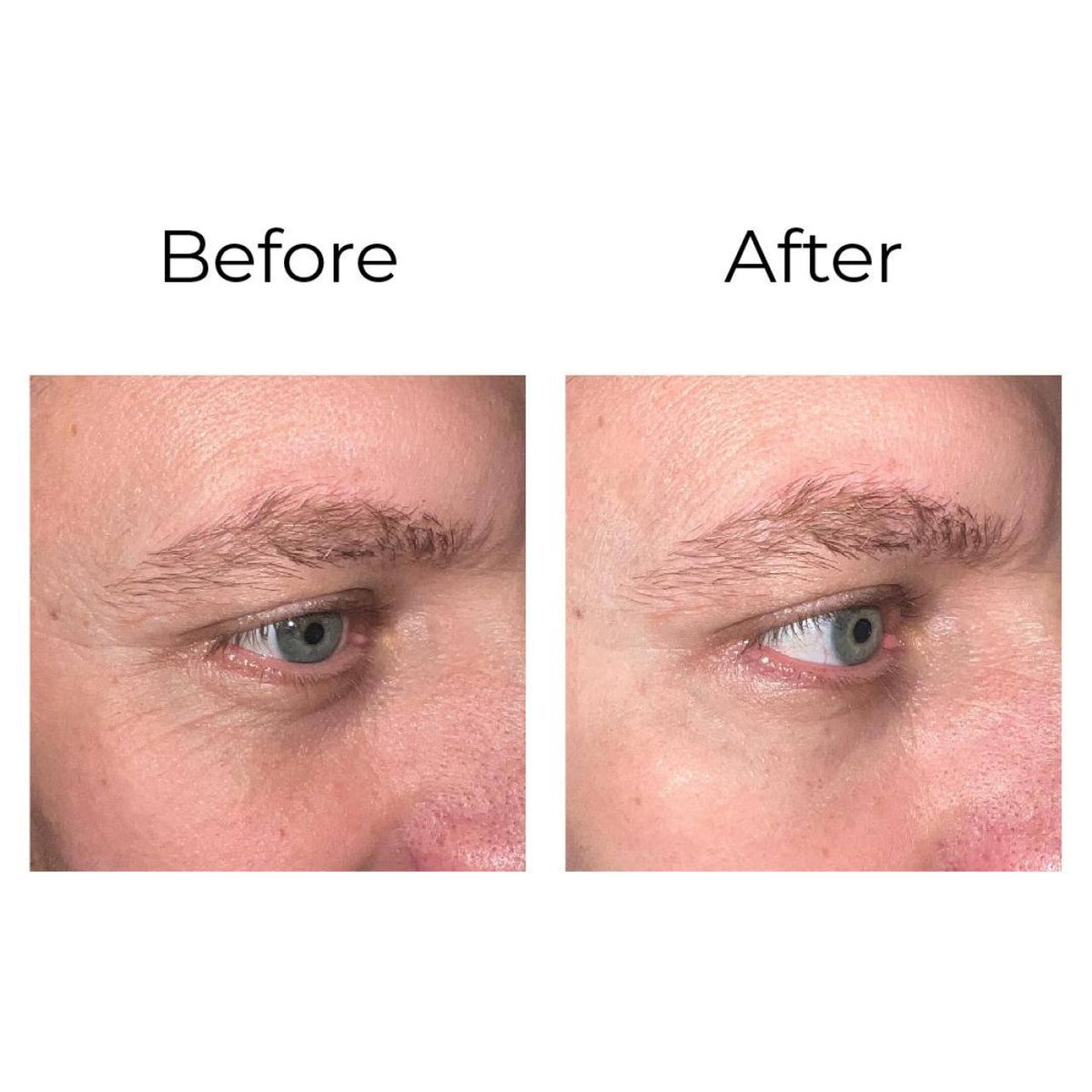 Crème yeux Shock Action Peptilux, application