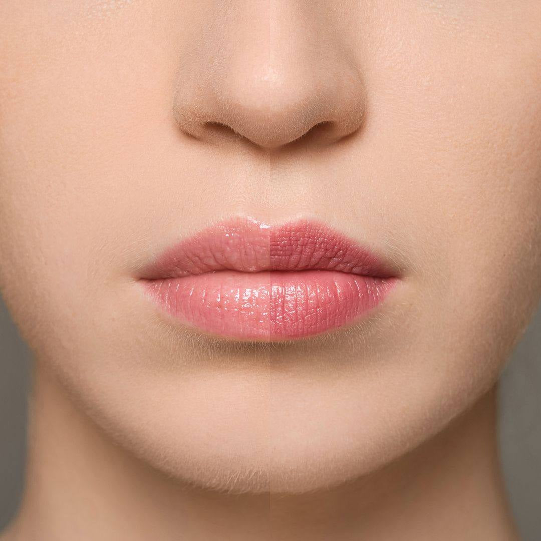 Supreme Lip Treatment – Fraise – photo 2